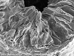 Proximal-tubule-conductive-staining